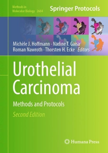 Urothelial Carcinoma