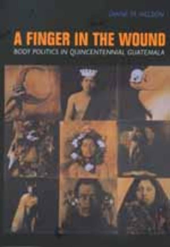 A Finger in the Wound
