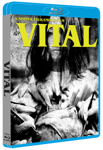 Vital