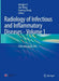Radiology of Infectious and Inflammatory Diseases - Volume 1