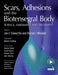 Scars, Adhesions and the Biotensegral Body