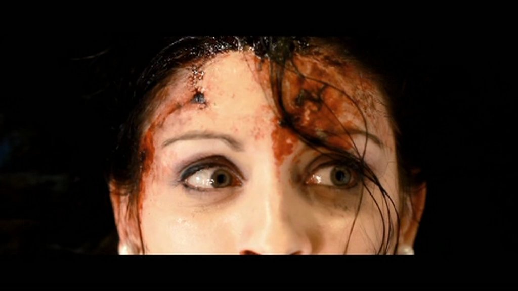Plastic Surgery Massacre