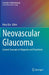 Neovascular Glaucoma