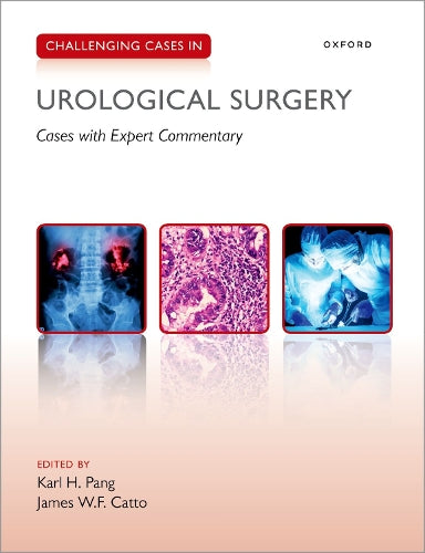 Challenging Cases in Urological Surgery: Cases With Expert Commentary (Challenging Concepts