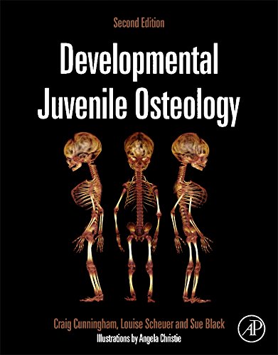 Developmental Juvenile Osteolo