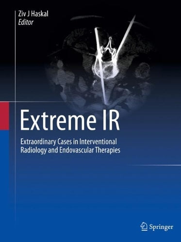 Extreme IR