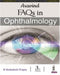 Aravind FAQs in Ophthalmology