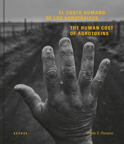 The Human Cost