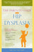 Parents' Guide to Hip Dysplasia