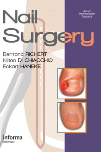 Nail Surgery: 7 (Series in Dermatological Treatment