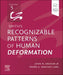 Smith's Recognizable Patterns of Human Deformation