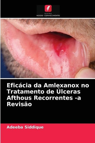 Eficácia da Amlexanox no Tratamento de Úlceras Afthous Recorrentes -a Revisão