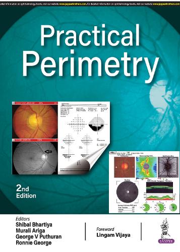 Practical Perimetry