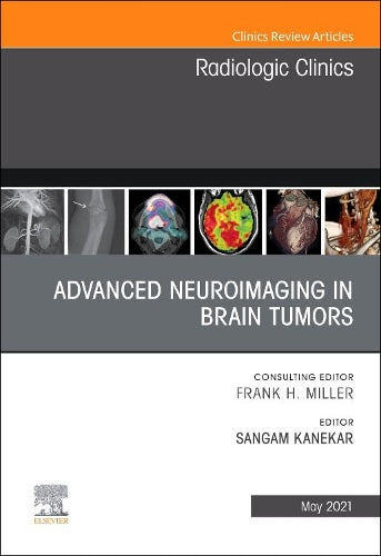 Advanced Neuroimaging in Brain Tumors, An Issue of Radiologic Clinics of North America (Volume 59-3) (The Clinics: Radiology, Volume 59-3