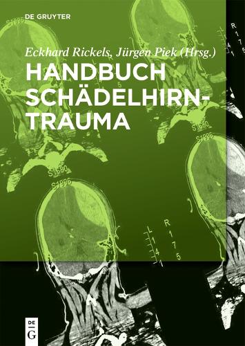 Handbuch Schädelhirntrauma (German Edition
