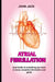 atrial fibrillation