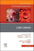 Lung Cancer, An Issue of Hematology/Oncology Clinics of North America