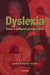 Dyslexia From A Cultural Perspective