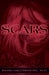 Scars