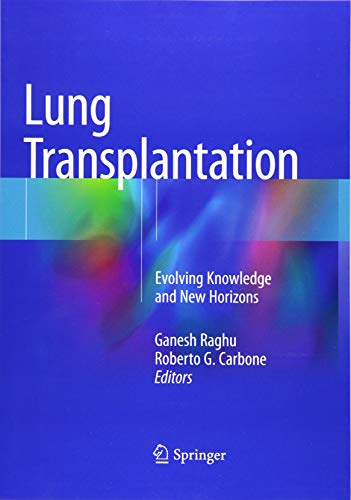 Lung Transplantation Softcover
