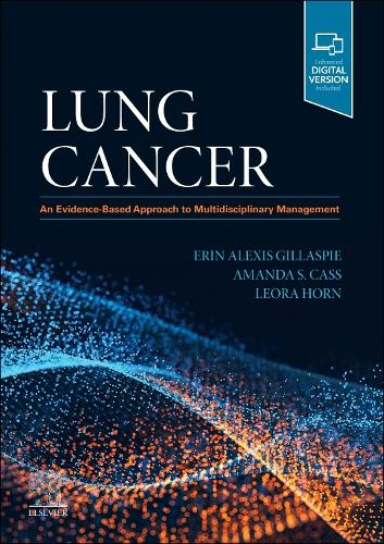 Lung Cancer: An Evidence-Based Approach To Multidisciplinary Management