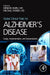 Global Clinical Trials For Alzheimer`S D