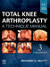 Total Knee Arthroplasty