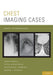 Chest Imaging Cases