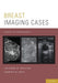 Breast Imaging Cases