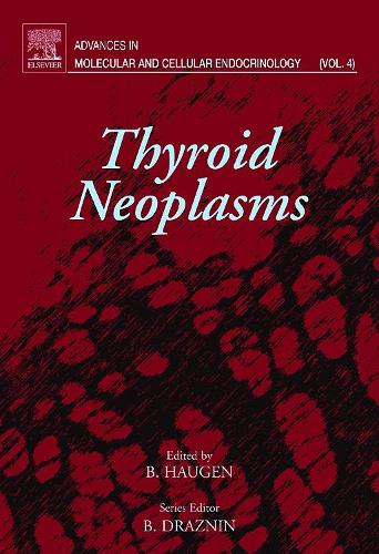 Thyroid Neoplasms