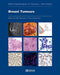 Breast Tumours 5/E