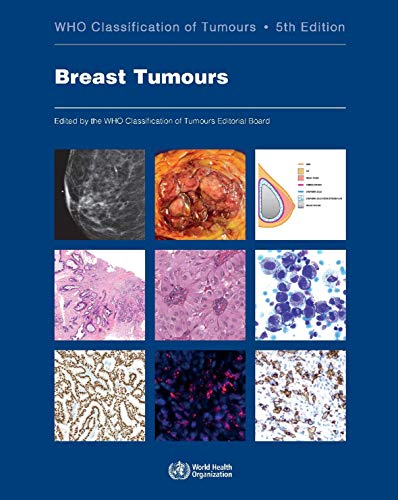 Breast Tumours 5/E
