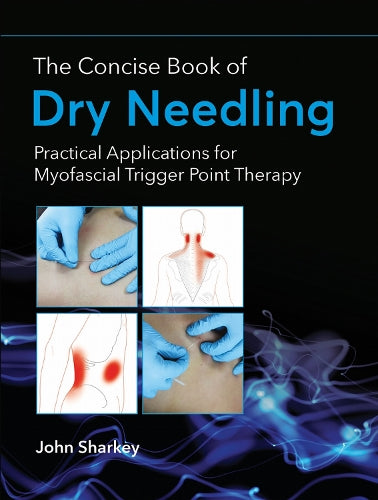 The Concise Book of Dry Needling