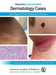 Dermatology Cases