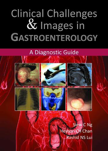 Clinical Challenges & Images in Gastroenterology