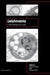 Leishmania