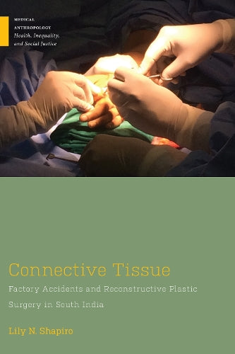 Connective Tissue