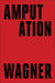 Amputation