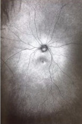 Supplement 3: The Invention and Conclusion of the Eye