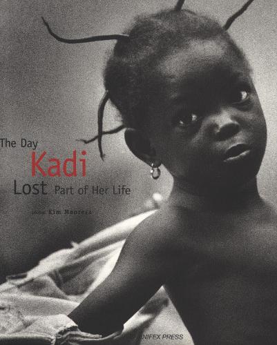 The Day Kadi Lost Part of Her Life