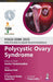 FOGSI EEBR 2025: Ethical Evidence-Based Recommendations: Polycystic Ovary Syndrome