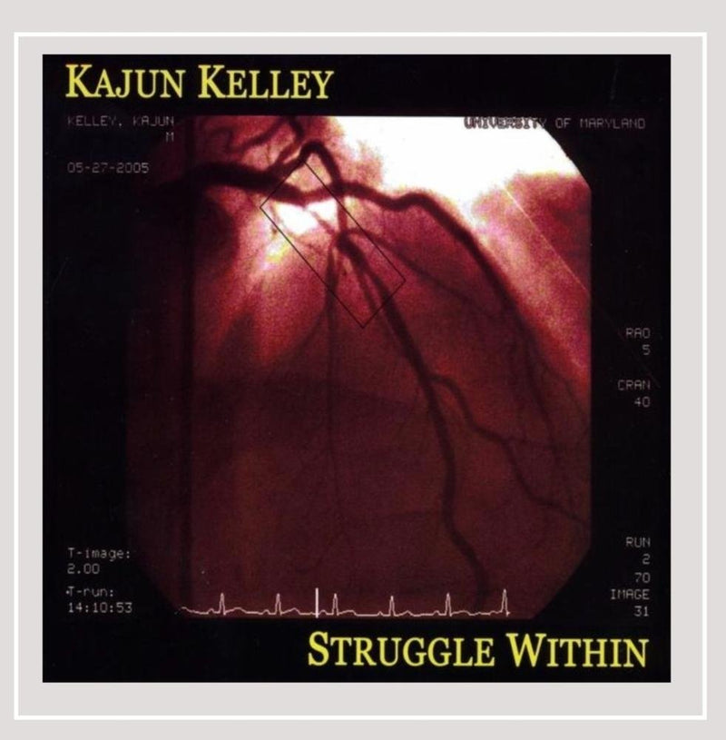 Struggle Within