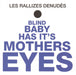 Blind Baby Has Its Mothers Eyes