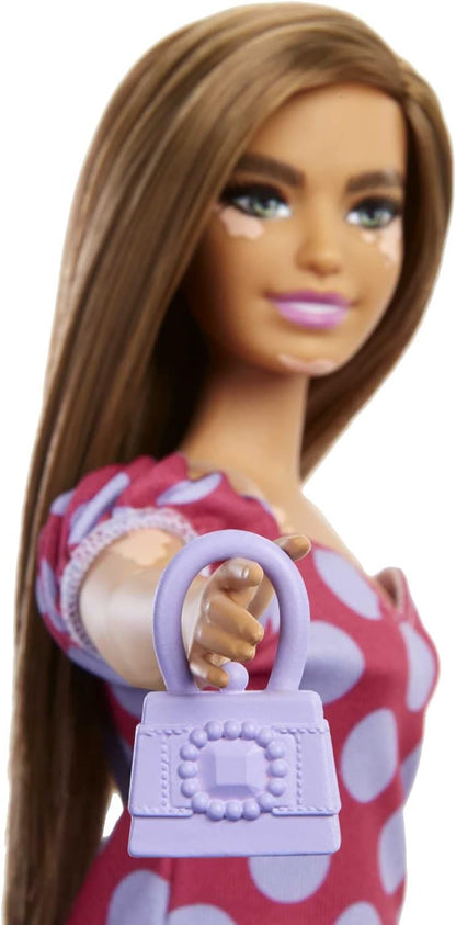 Barbie Fashionista Muñeca Curvy Vitiligo con Vestido de Lunares y Accesorios de Moda de Juguete (Mattel GRB62