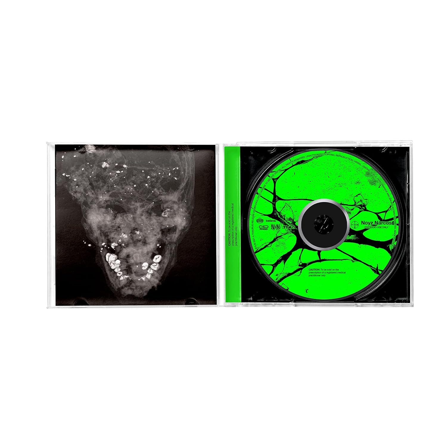 Virus