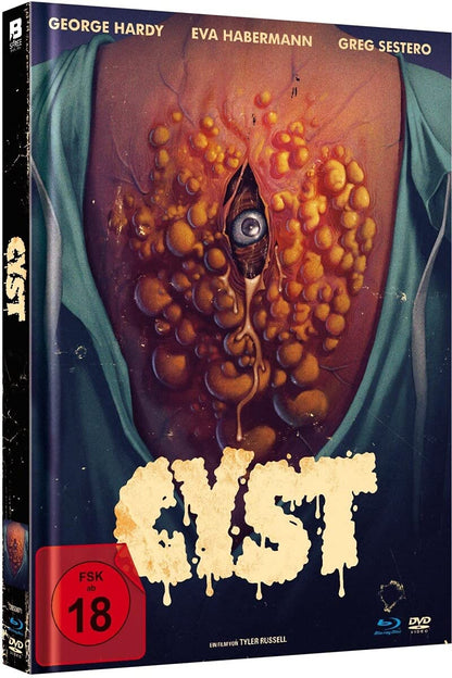 CYST - uncut S.E. Fassung (Limited Mediabook mit Blu-ray+DVD+Booklet)