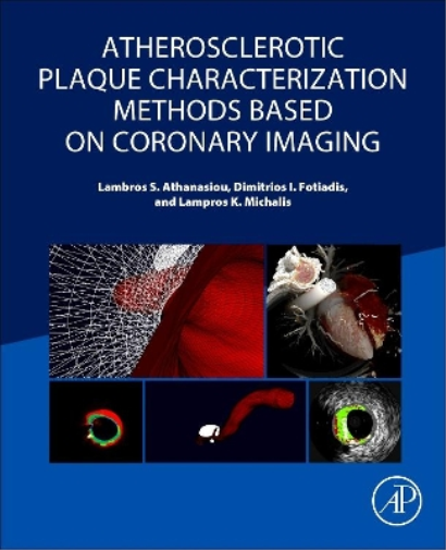 Atherosclerotic Plaque Characterization Methods Based on Coronary Imaging