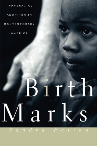 Birthmarks