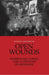 Open Wounds