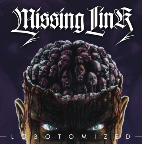 Lobotomized